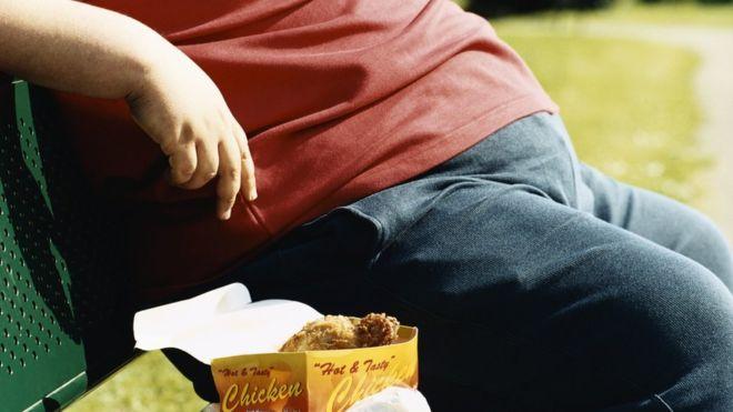 Obesity is on the rise in the developed world